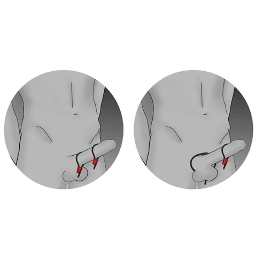 ELECTRASTIM - PRESTIGE ELECTRA LOOPS ANELLI PER IL PENE REGOLABILI ROSSI